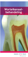 Wortelkanaalbehandeling